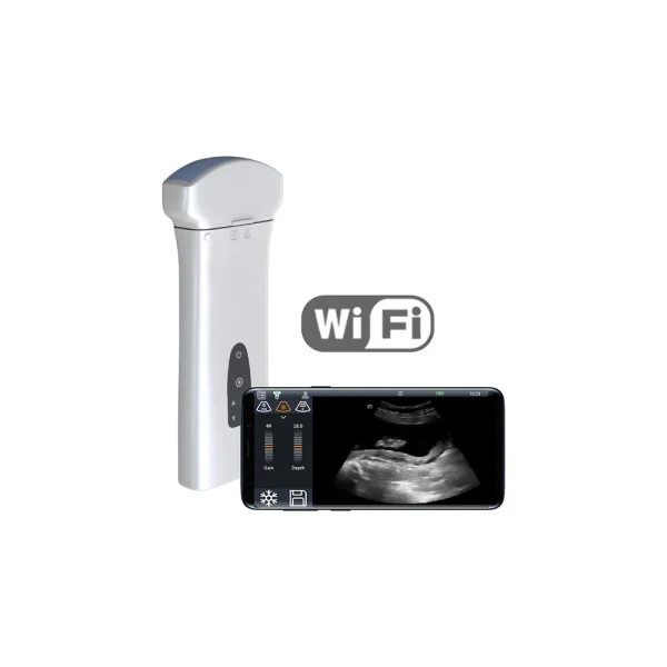 Бездротовий ультразвуковий датчик Youkey D8 (2 в 1)